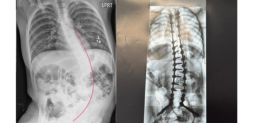 BlakeSpine copy.jpg